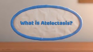 What is Atelectasis? (Complete or Partial Lung Collapse)