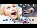 Why Are Wisdom Teeth Hard To Pull? Everything You Need to Know! (2021)