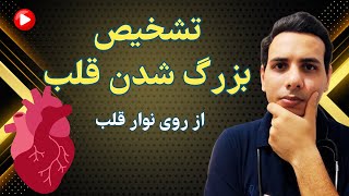 تشخیص سریع هایپرتروفی ها از روی نوار قلب | Rapid detection of hypertrophies on ECG