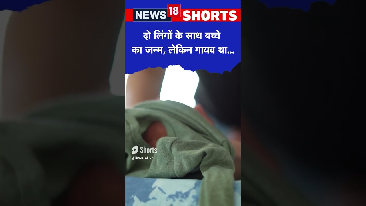 दो लिंग के साथ Pakistan में पैदा हुआ बच्चा, पर नहीं था ये बॉडी पार्ट ...