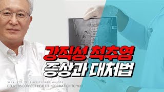 [E211] 강직성 척추염의 증상과 그 대처법