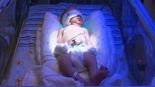 Drug-Dependent Infants Detox at Tenn. NICU
