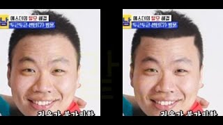 모발이식한 연예인을 포토샵으로 재 디자인