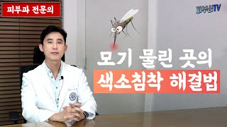 3분 피부 꿀팁! 모기 물린곳 검게 색소침착 생길 때 없애는법 [피부과전문의 피부심]