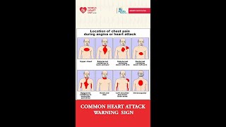 Common Heart Warning Sign | Dr. Byomakesh Dikshit- Cardiologist