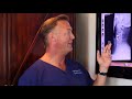 Can you remove cervical fusions and restore movement? | Dr. Todd Lanman