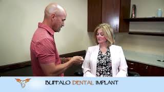 Full Mouth Implant (another success story) Buffalo Dental Implant story. We changed Dawn's life : )