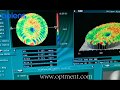 Inspect Optical Lens with ZYGO Interferometer