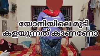 യോനിയിലെ മുടി കളയുന്നത് നേരിട്ട് കാണണോ ||