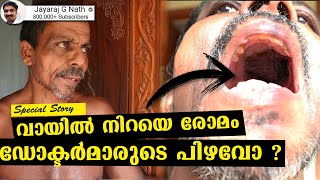 വായില്‍ നിറയെ രോമം ! ഡോക്ടര്‍മാരുടെ പിഴവോ ?