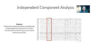 EEG Ocular Correction using Independent Component Analysis (ICA)