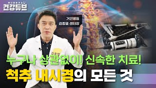 [KNN건강튜브] 척추 치료에 한 획을 긋다! 아무나 척추 수술이👌?! 척추 내시경의 모든것!