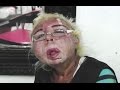 Man disfigures Own Face Trying to Look Like a Woman- Hugo Hernandez Garcia