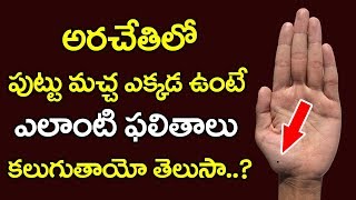 Unknown Facts About Moles on Palm | Mole on the Palm to Know the Secret of Luck  | Palmistry  YOYOTV