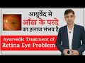 Ayurvedic Treatment for Retina Eye Problems || आयुर्वेद से आँख के परदे का इलाज संभव है