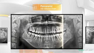 Rayscan Alpha plus CBCT