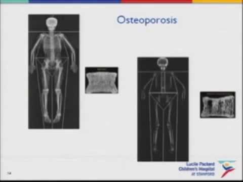 What is the age related pattern of acute and chronic diseases over adulthood?