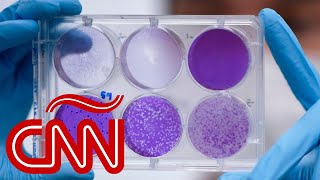 "Eventualmente todos nos contagiaremos del coronavirus", dice el doctor Elmer Huerta