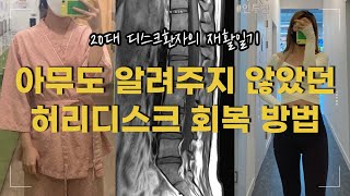 20대 디스크환자의 비수술치료 성공후기 | 재활생활 꿀팁 | 허리디스크환자가 기억해야할 세가지 | 재활센터 추천 | 디스크환자브이로그