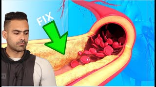 Clean Your Arteries And Prevent Heart Attack ( ਹਾਰਟ ਅਟੈਕ ਤੋਂ ਬਚੋ )