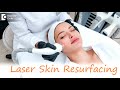 Laser Skin Resurfacing: Types, Conditions it Treats & Procedure Explained - Dr. Rajdeep Mysore