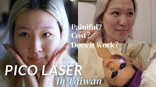 TAIWAN VLOG - IS PICO LASER WORTH IT ?? Skin treatment in Taiwan - Costs? Where to go? 皮秒雷射體驗