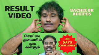 Result Video சொட்டை தலையில் முடி வளரும்