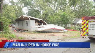 Dothan man caught in house fire, quarter of his body burned