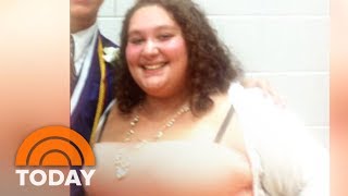 See The Healthy Meals That Helped 1 Young Woman Lose 150 Pounds | TODAY