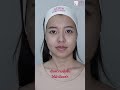 งานผิวสุดปัง แบบ glass skin ✨ annaclinic beloterorevive filler