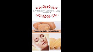 Method-1 Potato For Under Eyes Dark Circles | DIY for dark circles | Dark circle removal home remedy