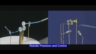 Cardiac Ablation Catheter Precision and Reach with Stereotaxis RMN