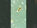 lemon juice vs bacteria under microscope.