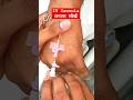 IV Cannula कैसे लगाते हैं How to insert IV Cannula Types of IV Cannula, IV Cannula According to Age