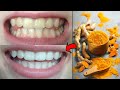 You will get pearly white teeth within a minute! Simple recipe