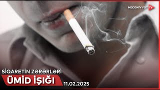 Ümid işığı - Siqaretin zərərləri | 11.02.2025