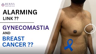 Is There a Link Between Gynecomastia \u0026 Breast Cancer? Explained by Dr. Arth Shah