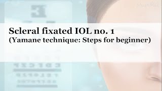 Scleral fixated IOL no. 1 (Yamane technique: Steps for beginner)