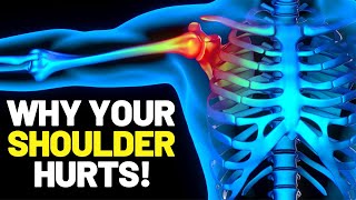 What is Causing Your Shoulder Pain? Tests You Can Do Yourself