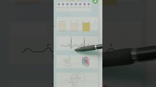 5-Step EKG Interpretation!🫀#nclex #nursing #nursingstudent #nurselife #nclex_rn #ekg #nclexprep