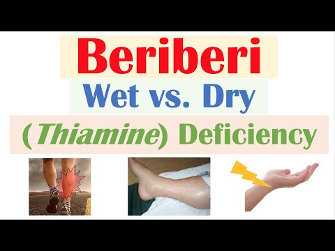 Is beriberi a contagious disease?