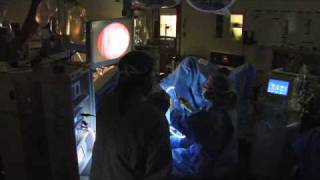 Holmium Laser for BPH-Mayo Clinic