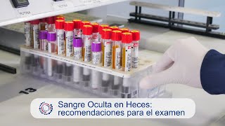 Sangre Oculta En Heces Recomendaciones Para El Examen Doovi