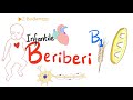 infantile beriberi vitamin b1 deficiency thiamine deficiency