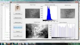 Implementation Image Enhancement using Histogram Equilization & Negative of Image with MATLAB