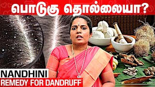 பொடுகை விரட்ட எளிய வழி | How to remove Dandruff | Doctor Nandhini | Aadhan Clinic