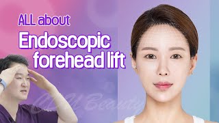 All about Endoscopic forehead lift