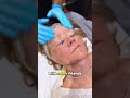 the magic of full face rejuvenation skincare cosmeticenhancement hairremovaltreatment filler