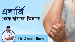 এলার্জি কেন হয় ?এলার্জি থেকে মুক্তির উপায় | Allergy Symptoms, Causes \u0026 Treatment | Episode No.-486