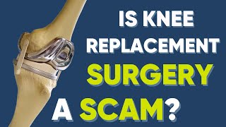 Is Knee Replacement a SCAM ? #totalkneereplacement #kneearthritis #doctor